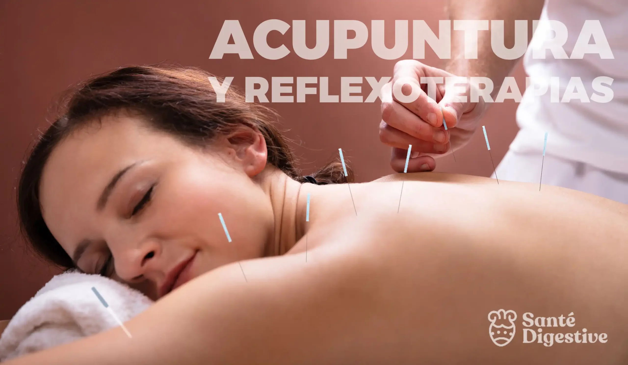 Sesión de acupuntura en Santé Digestive para aliviar el estrés, mejorar la circulación, control del dolor crónico y restaurar el equilibrio energético.